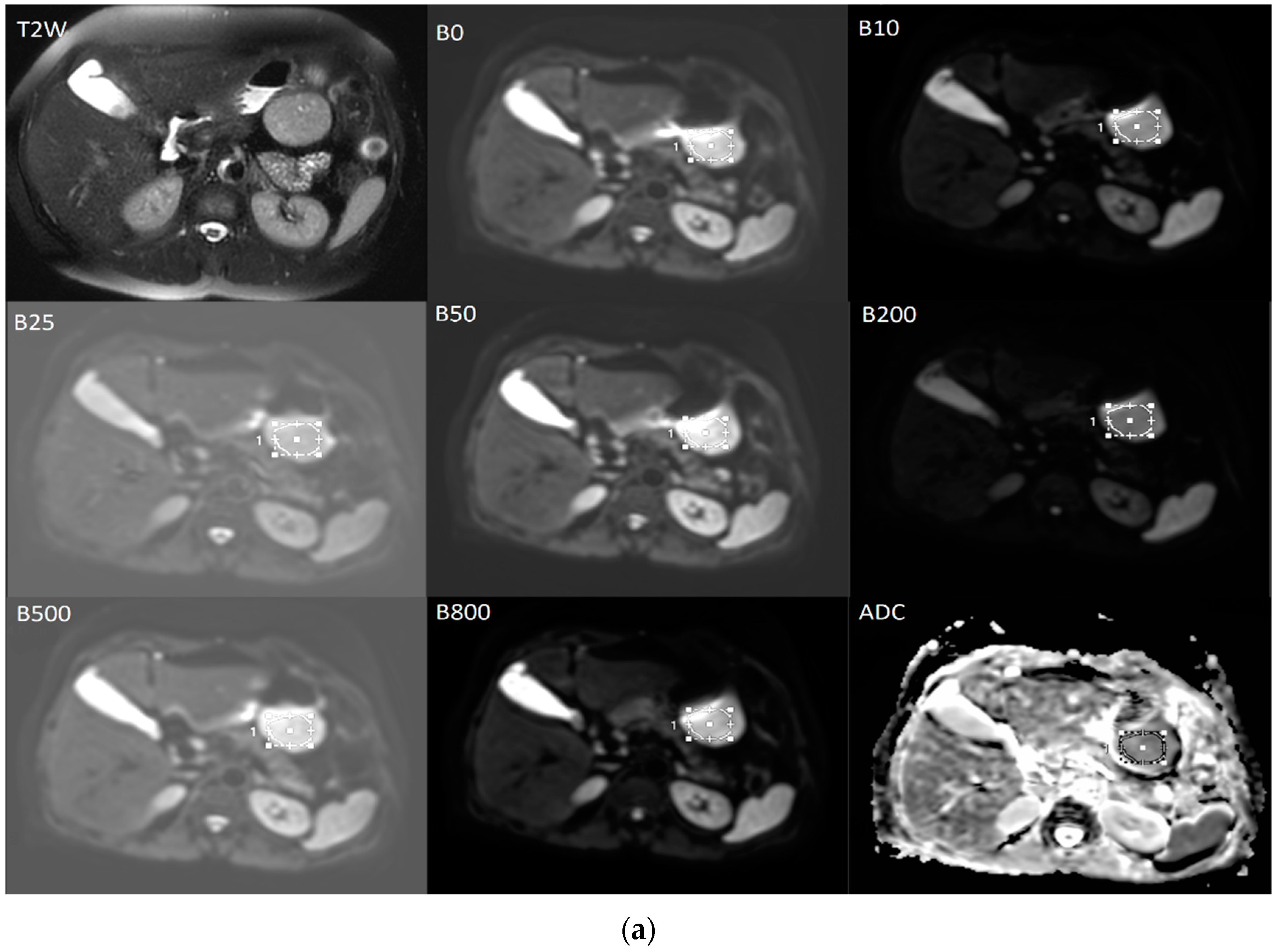 Diagnostics 12 02841 g006a Diagnostics 12 02841 g006a