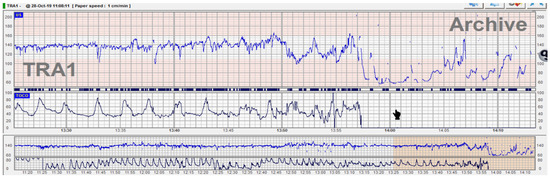 Diagnostics 12 02845 g001