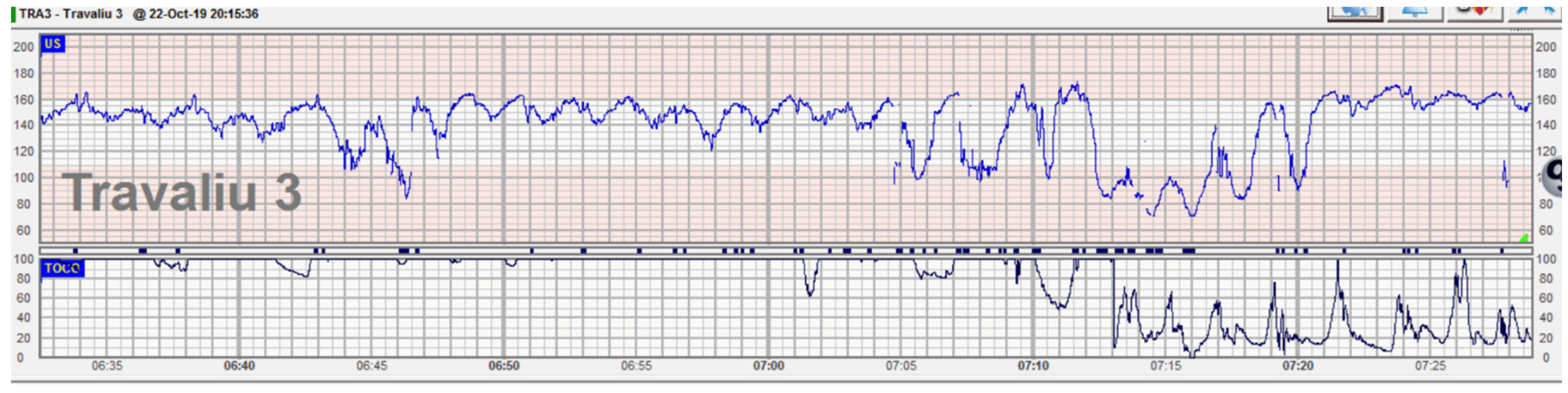 Diagnostics 12 02845 g003