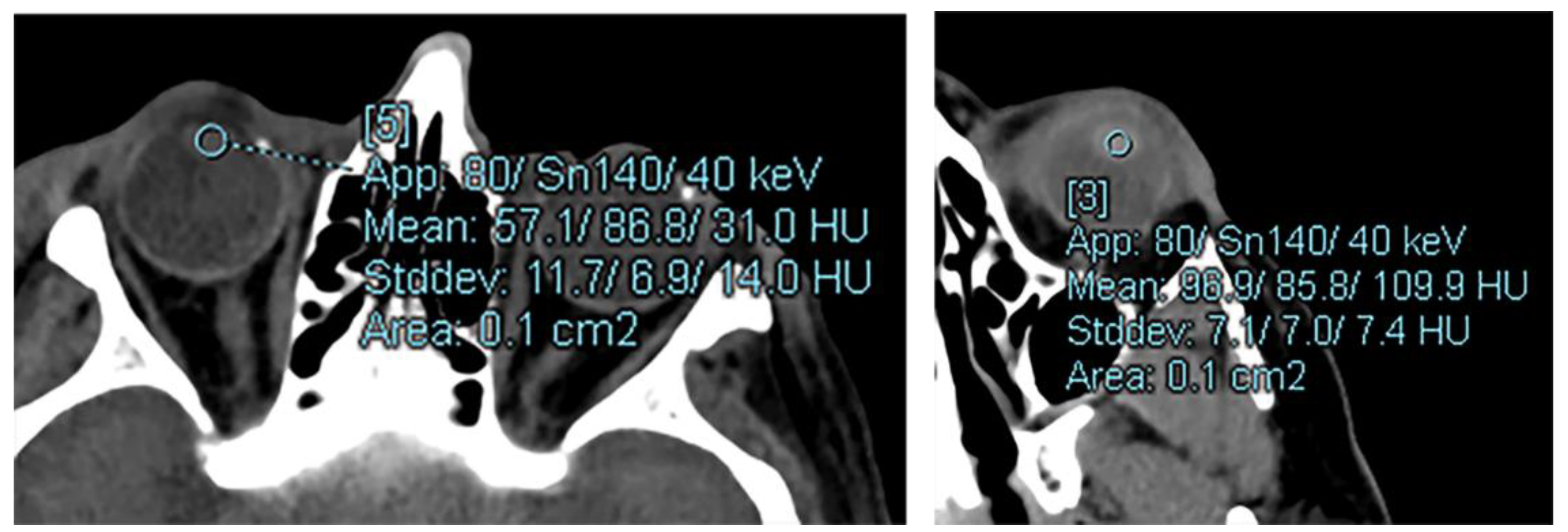 Diagnostics 12 02857 g001
