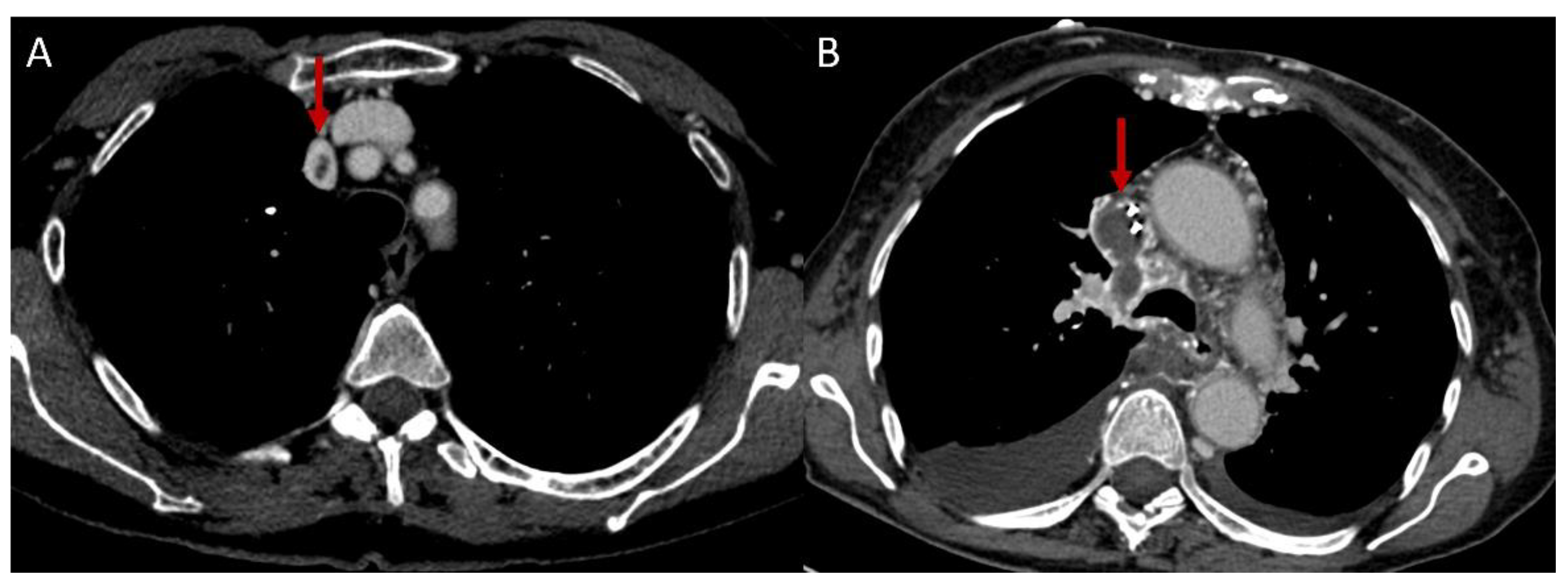 Diagnostics 12 02868 g005
