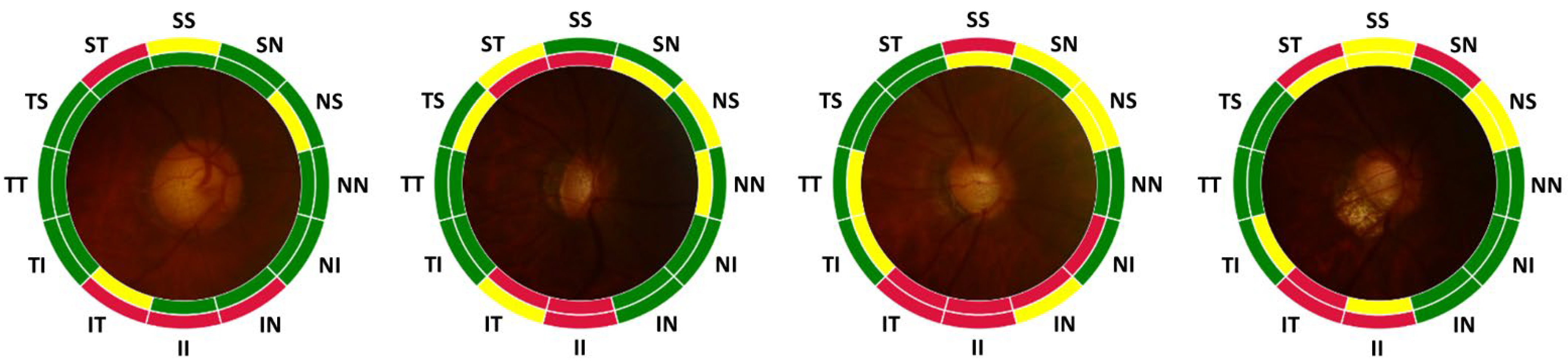 Diagnostics 12 02894 g008