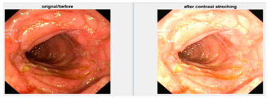 Diagnostics 12 02898 i001