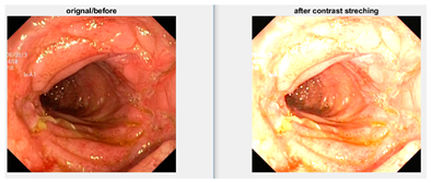 Diagnostics 12 02898 i002