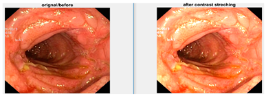 Diagnostics 12 02898 i004