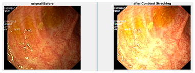 Diagnostics 12 02898 i005