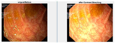 Diagnostics 12 02898 i006