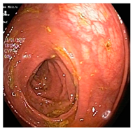 Diagnostics 12 02898 i011