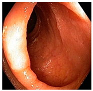 Diagnostics 12 02898 i012