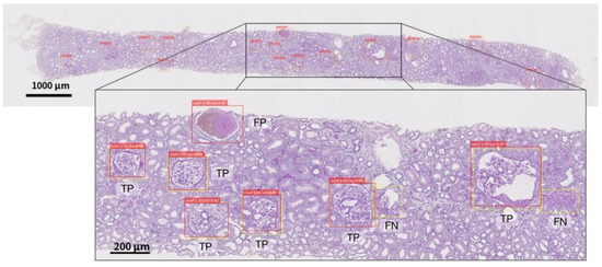 Diagnostics 12 02955 g0a2