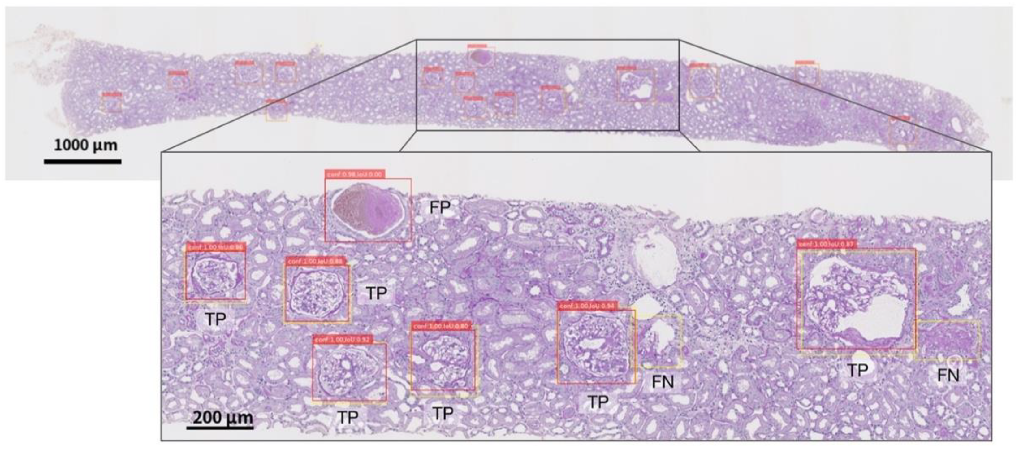 Diagnostics 12 02955 g0a2 Diagnostics 12 02955 g0a2