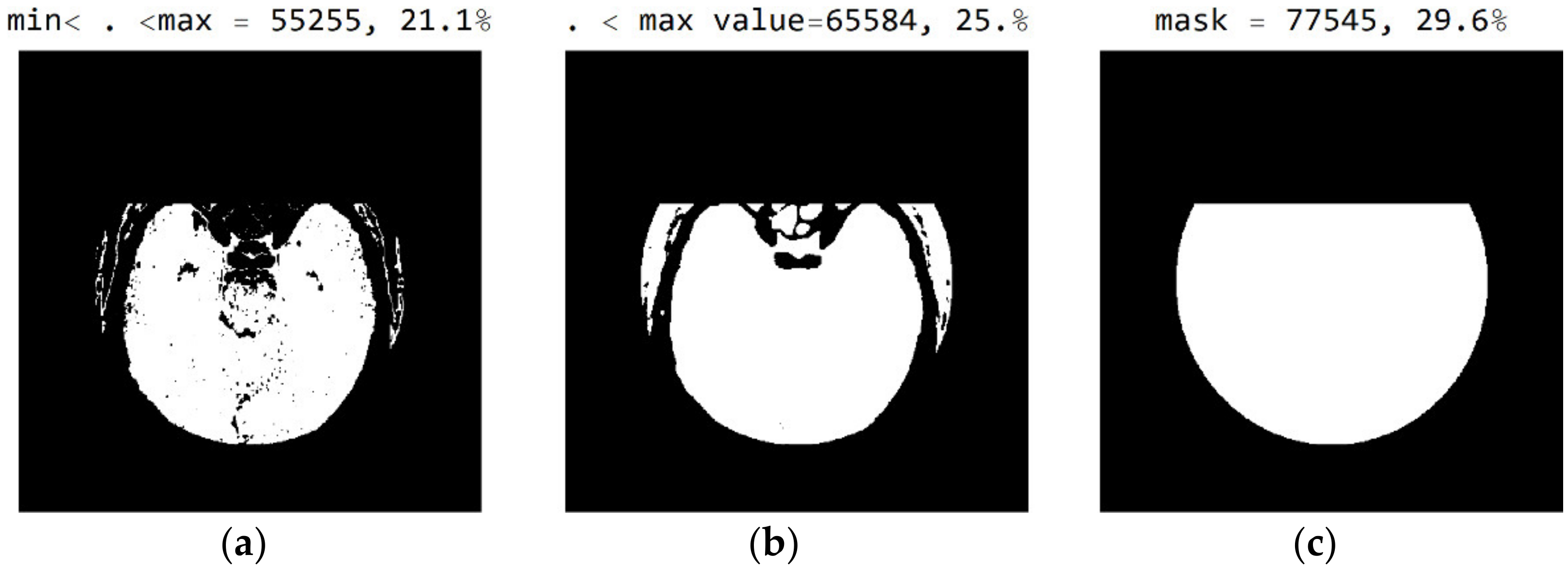 Diagnostics 12 03208 g010 Diagnostics 12 03208 g010