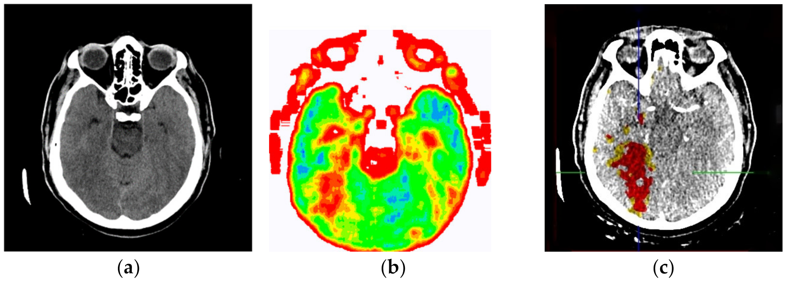 Diagnostics 12 03208 g013 Diagnostics 12 03208 g013