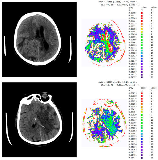 Diagnostics 12 03208 g0a3a Diagnostics 12 03208 g0a3a