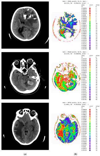 Diagnostics 12 03208 g0a3b