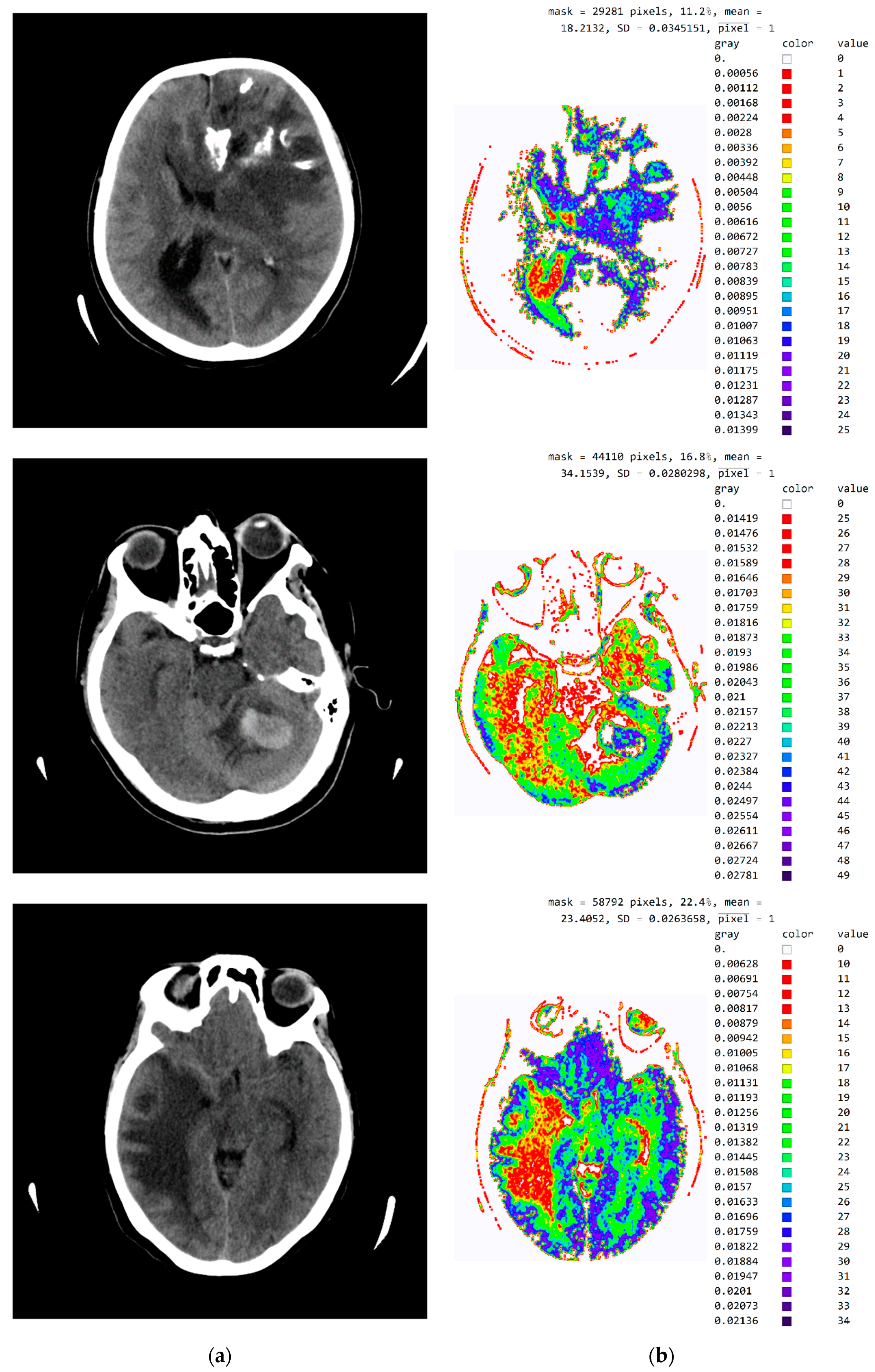 Diagnostics 12 03208 g0a3b Diagnostics 12 03208 g0a3b