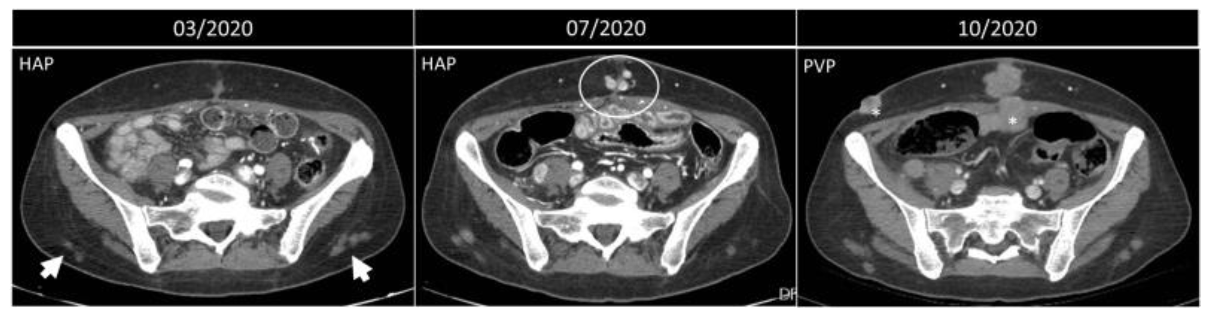 Diagnostics 12 03211 g012