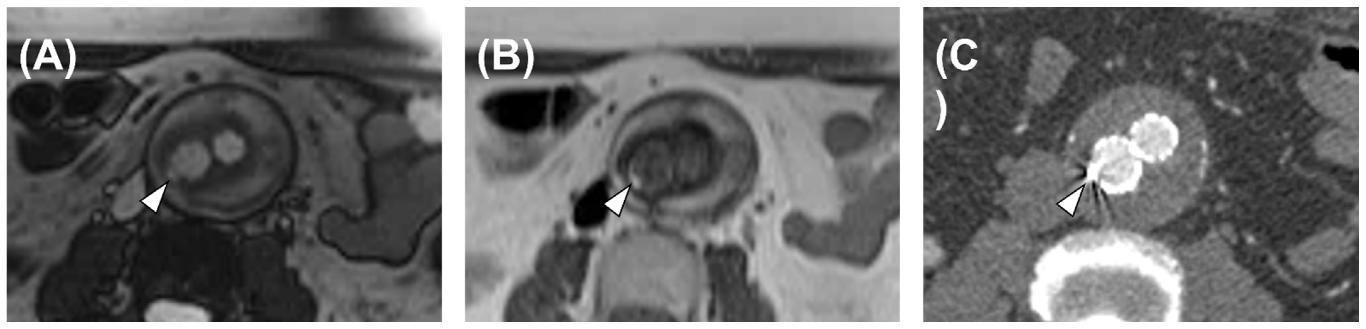 Diagnostics 13 00020 g002 Diagnostics 13 00020 g002