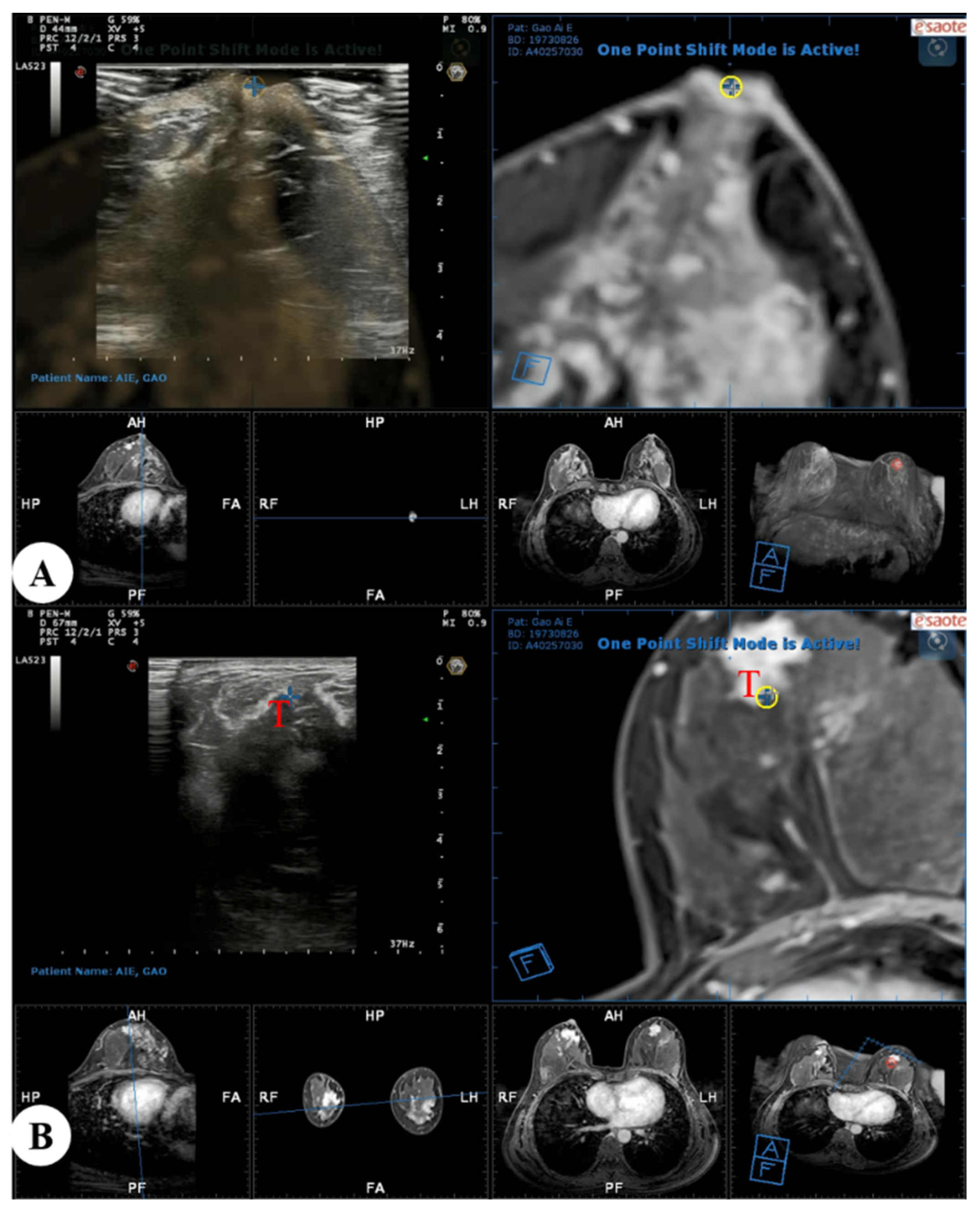 Diagnostics 13 00029 g003 Diagnostics 13 00029 g003