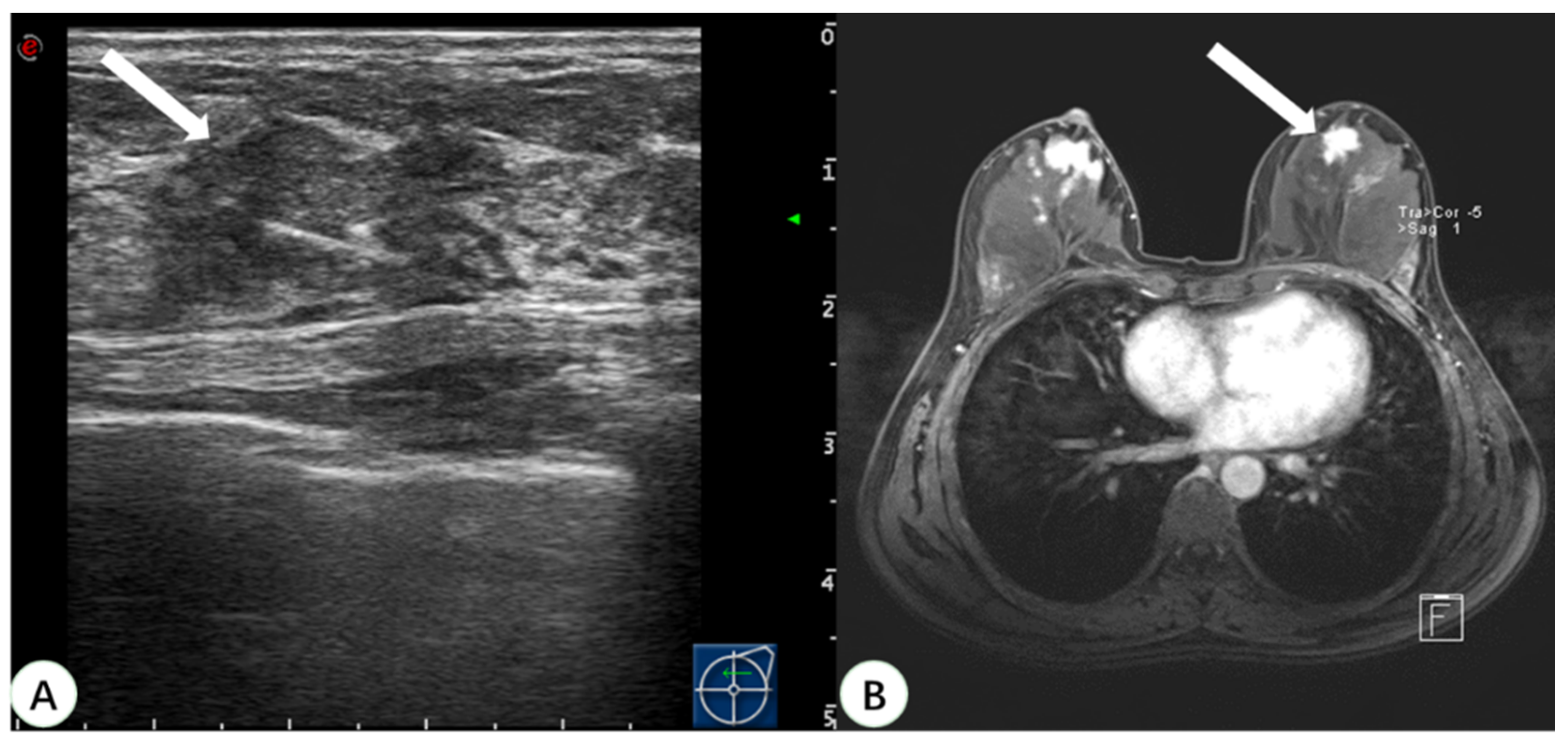 Diagnostics 13 00029 g004 Diagnostics 13 00029 g004