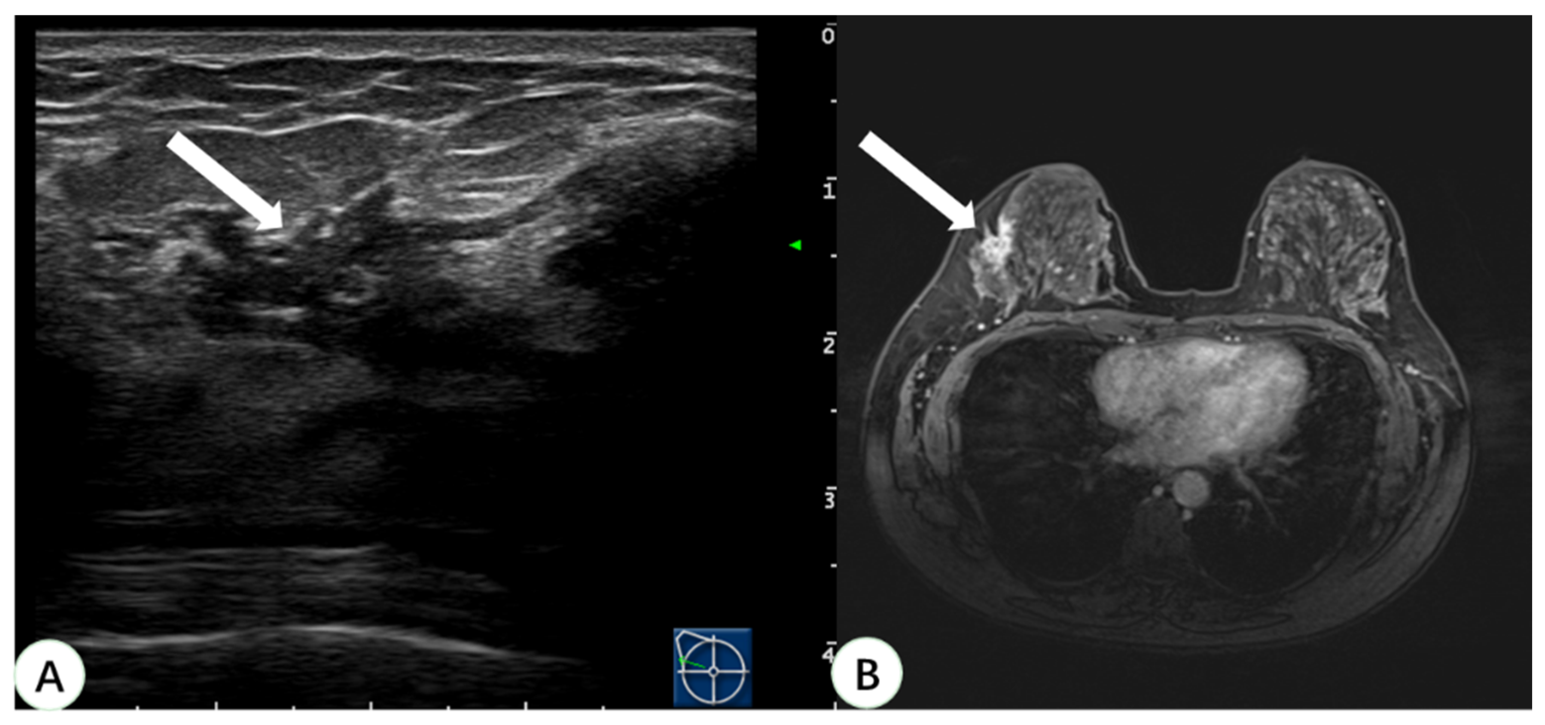 Diagnostics 13 00029 g005 Diagnostics 13 00029 g005