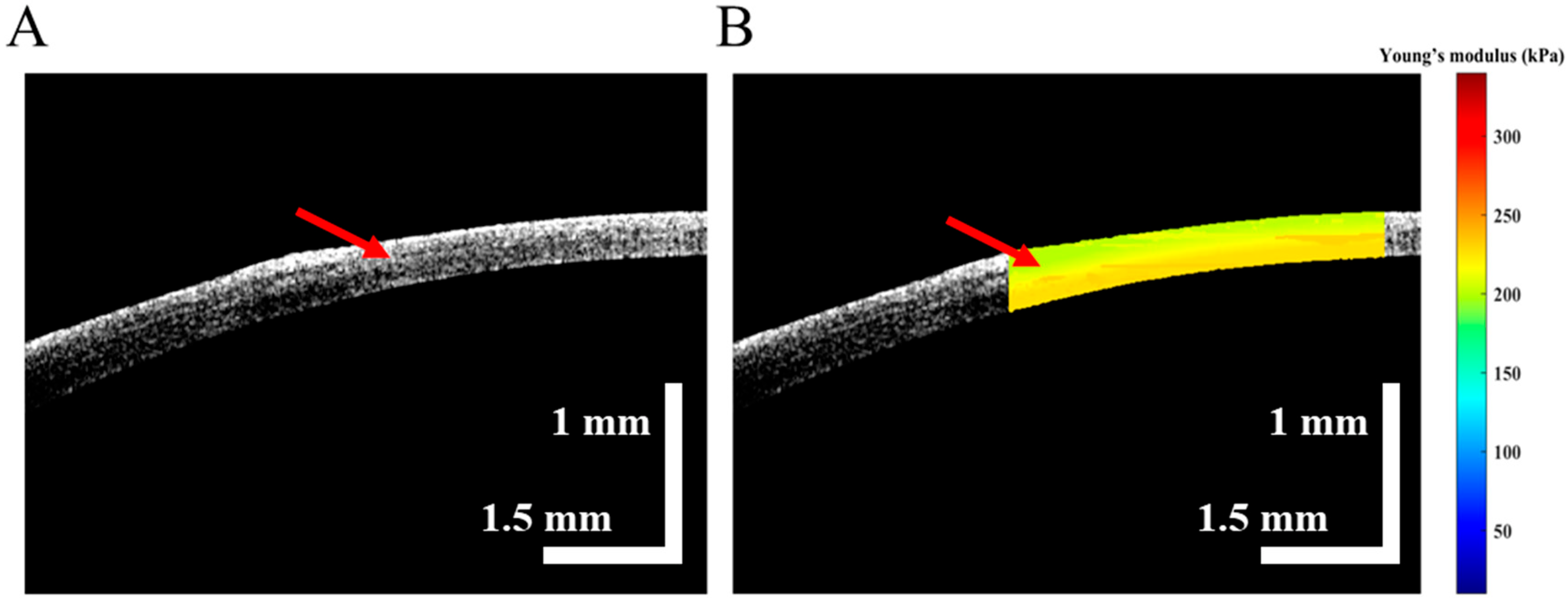 Diagnostics 13 00030 g006 Diagnostics 13 00030 g006