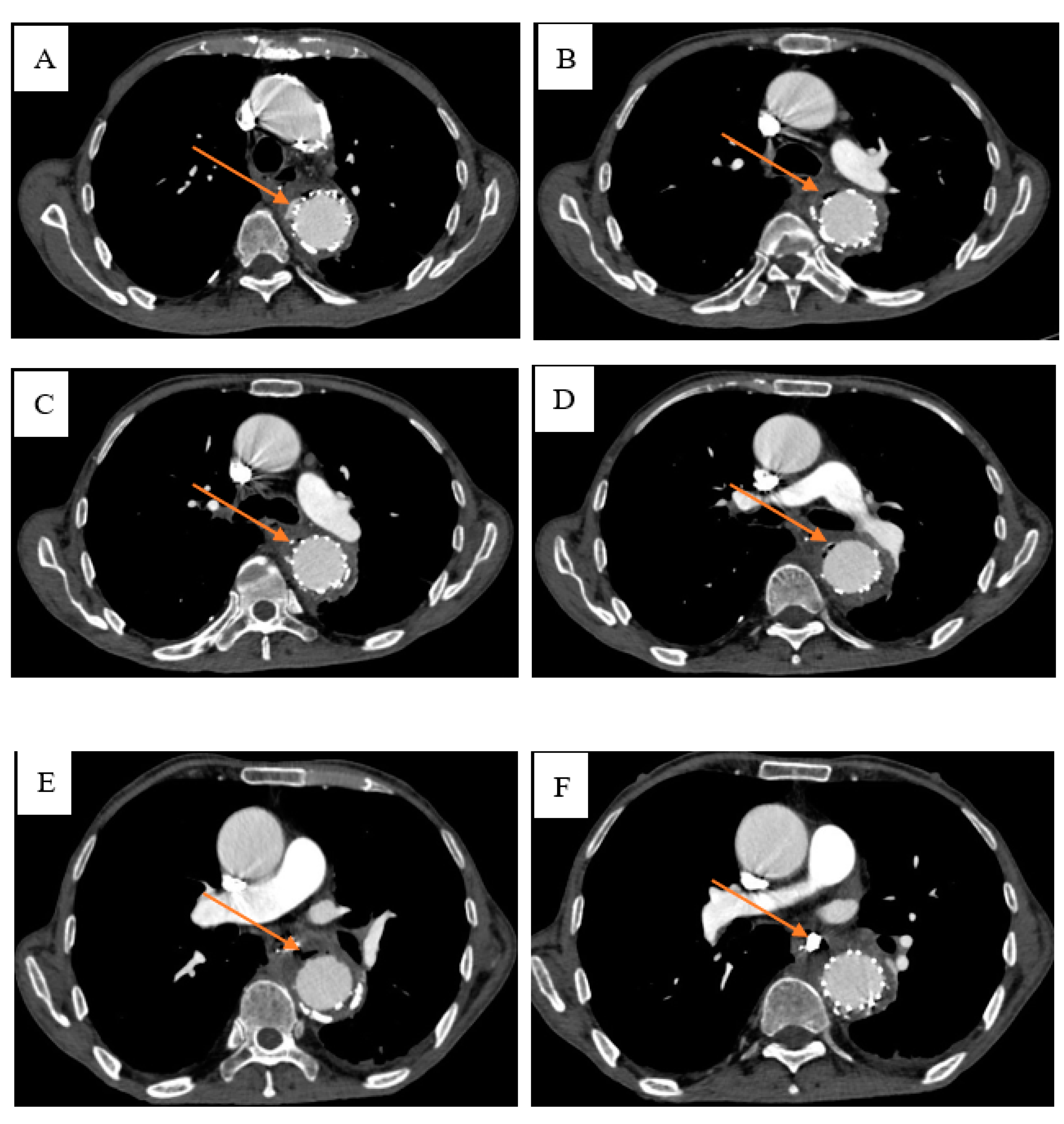 Diagnostics 13 00040 g006