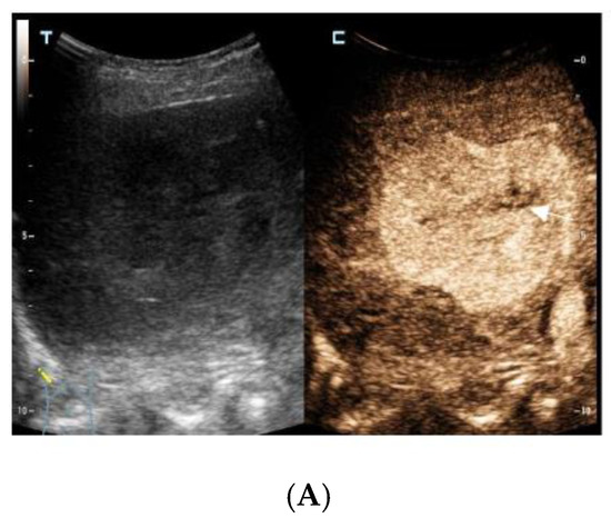 Diagnostics 13 00042 g001a