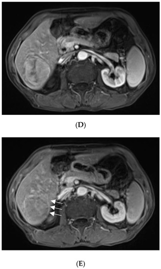 Diagnostics 13 00042 g002b
