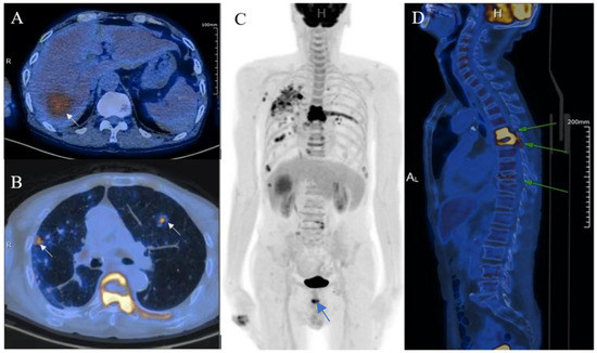 Diagnostics 13 00042 g003
