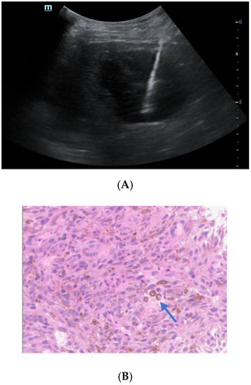 Diagnostics 13 00042 g004