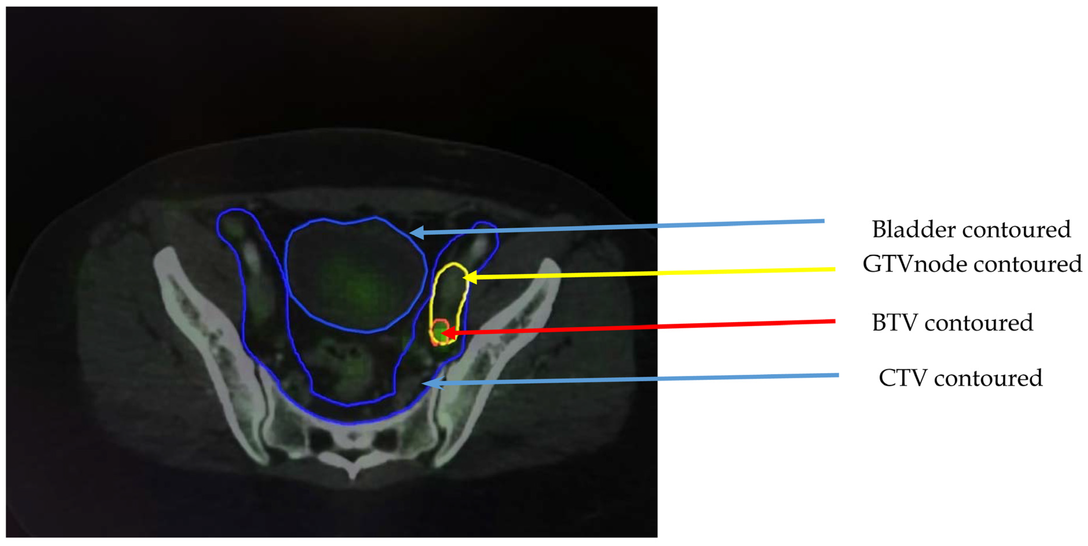Diagnostics 13 00053 g002 Diagnostics 13 00053 g002
