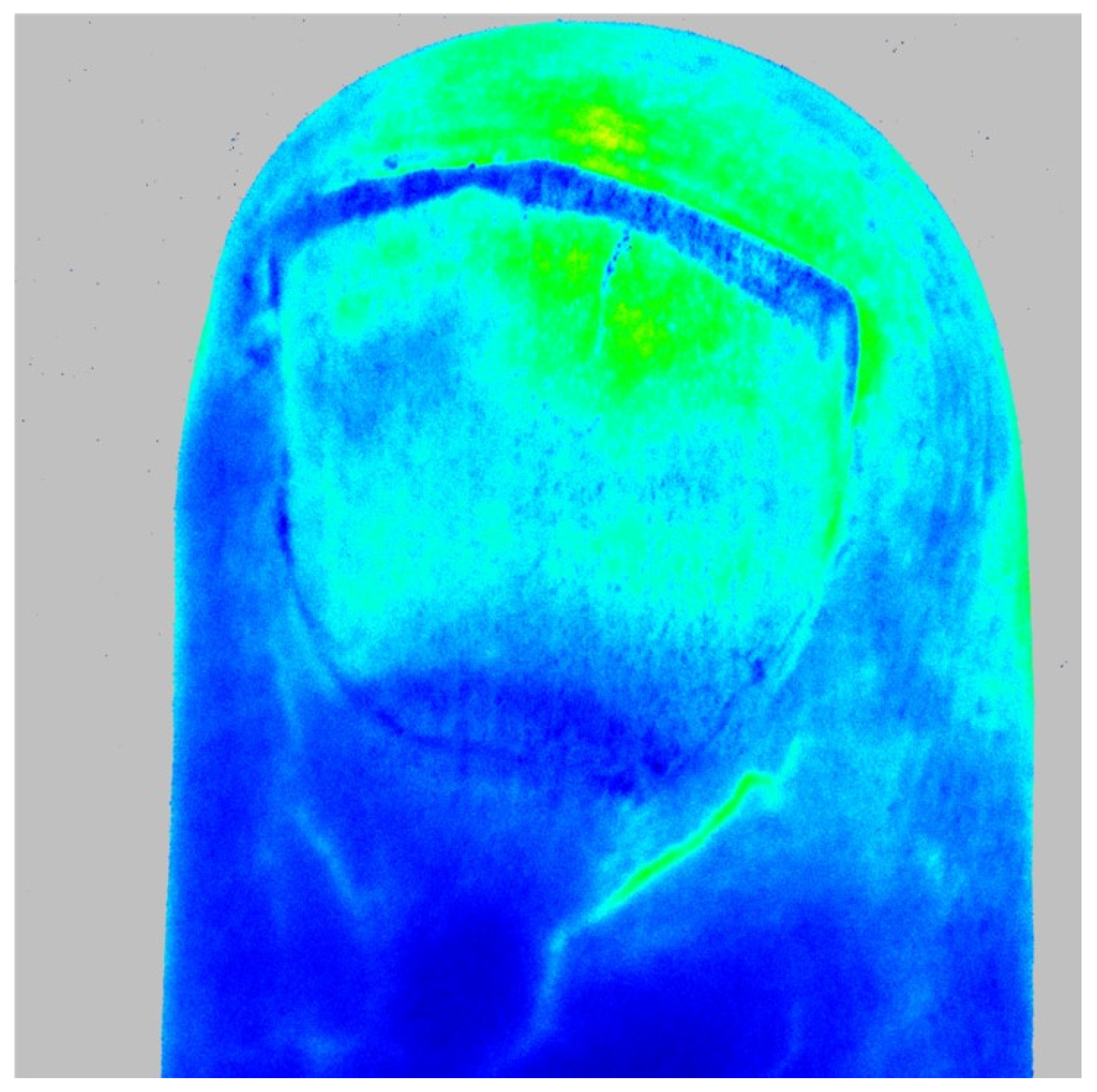 Diagnostics 13 00055 g002