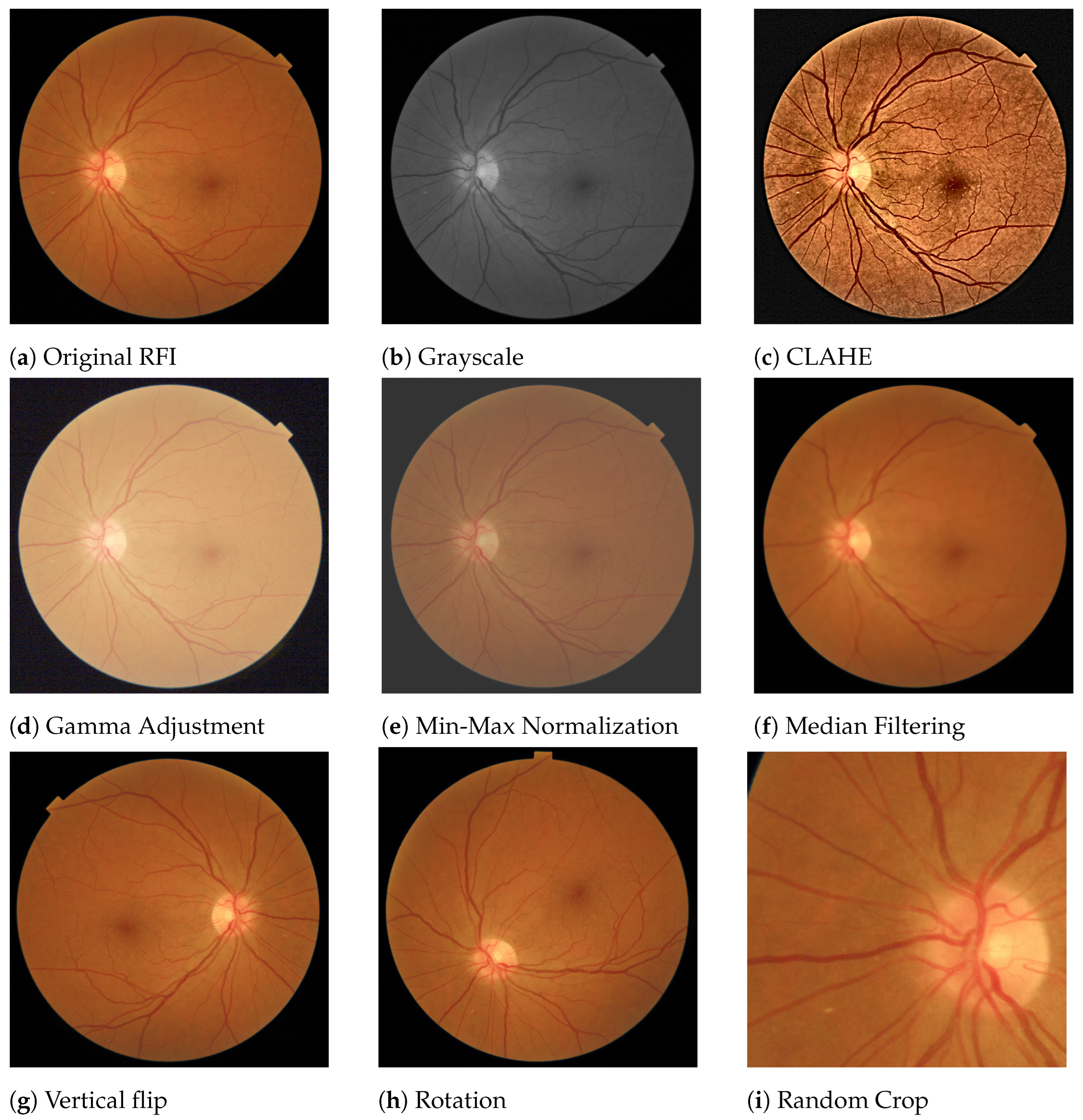 Diagnostics 13 00068 g004