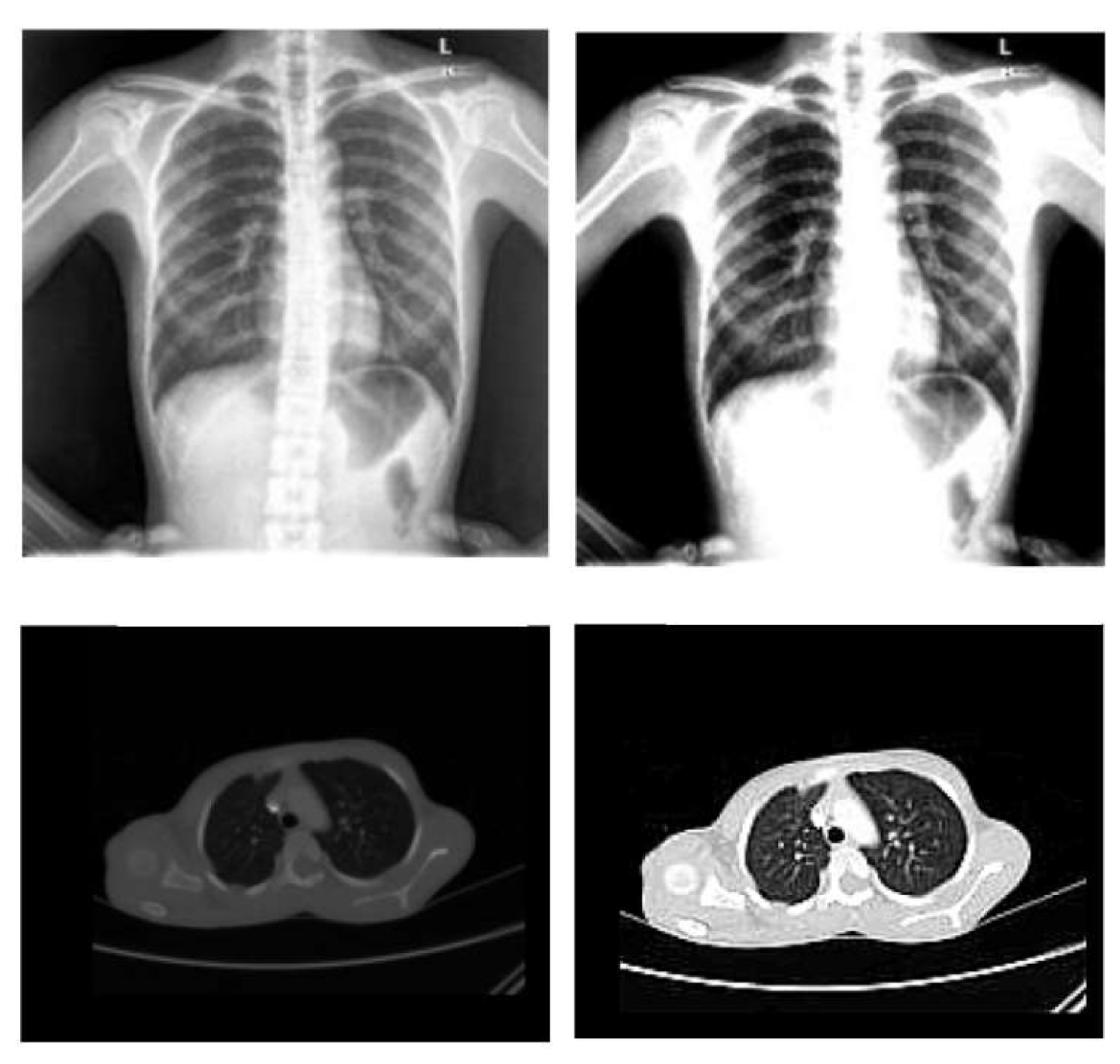 Diagnostics 13 00076 g002 Diagnostics 13 00076 g002