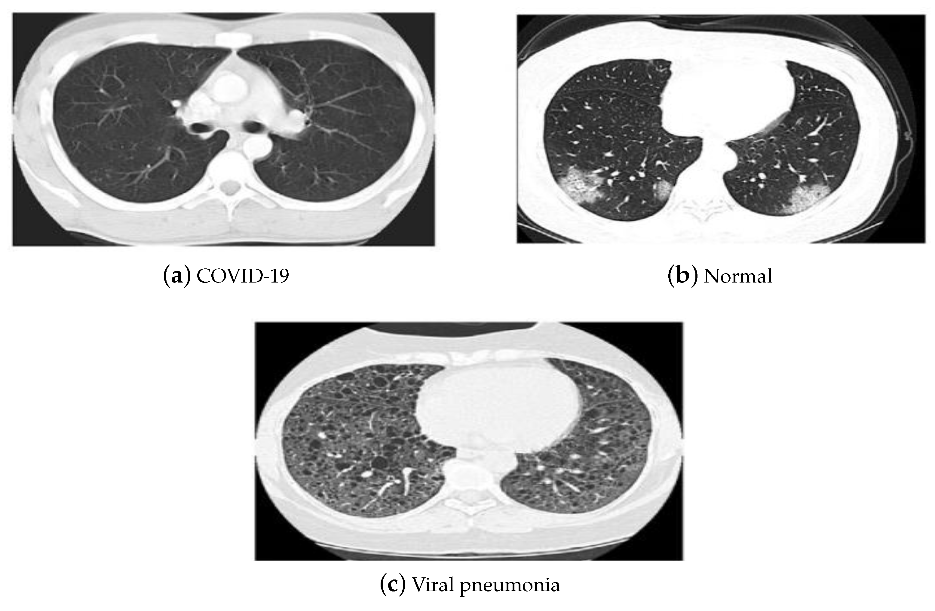 Diagnostics 13 00076 g005 Diagnostics 13 00076 g005