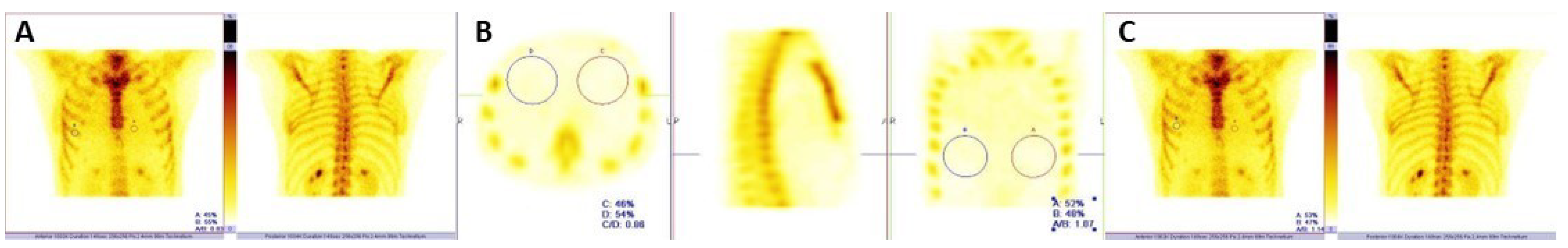 Diagnostics 13 00083 g005 Diagnostics 13 00083 g005