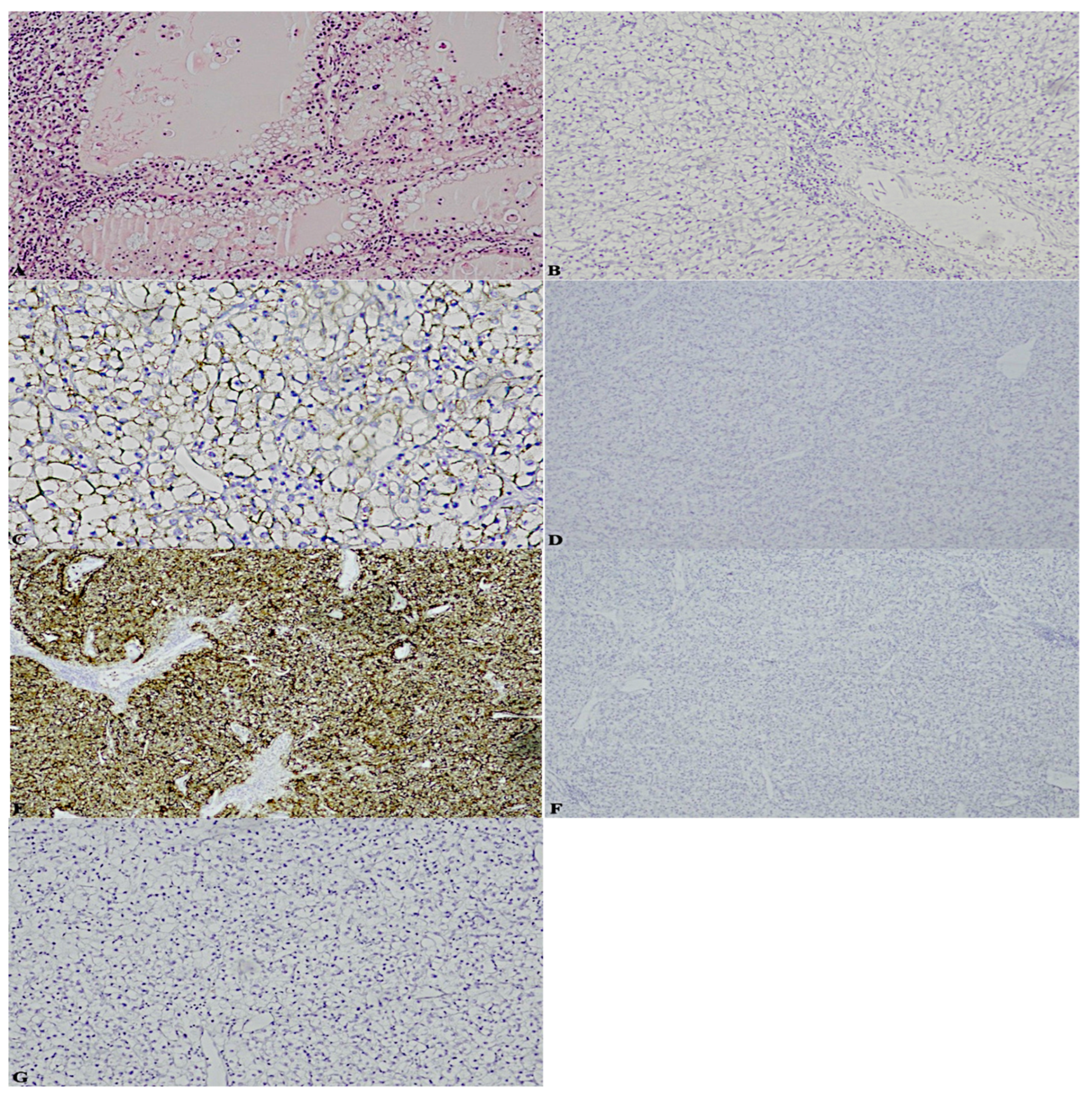 Diagnostics 13 00086 g003 Diagnostics 13 00086 g003