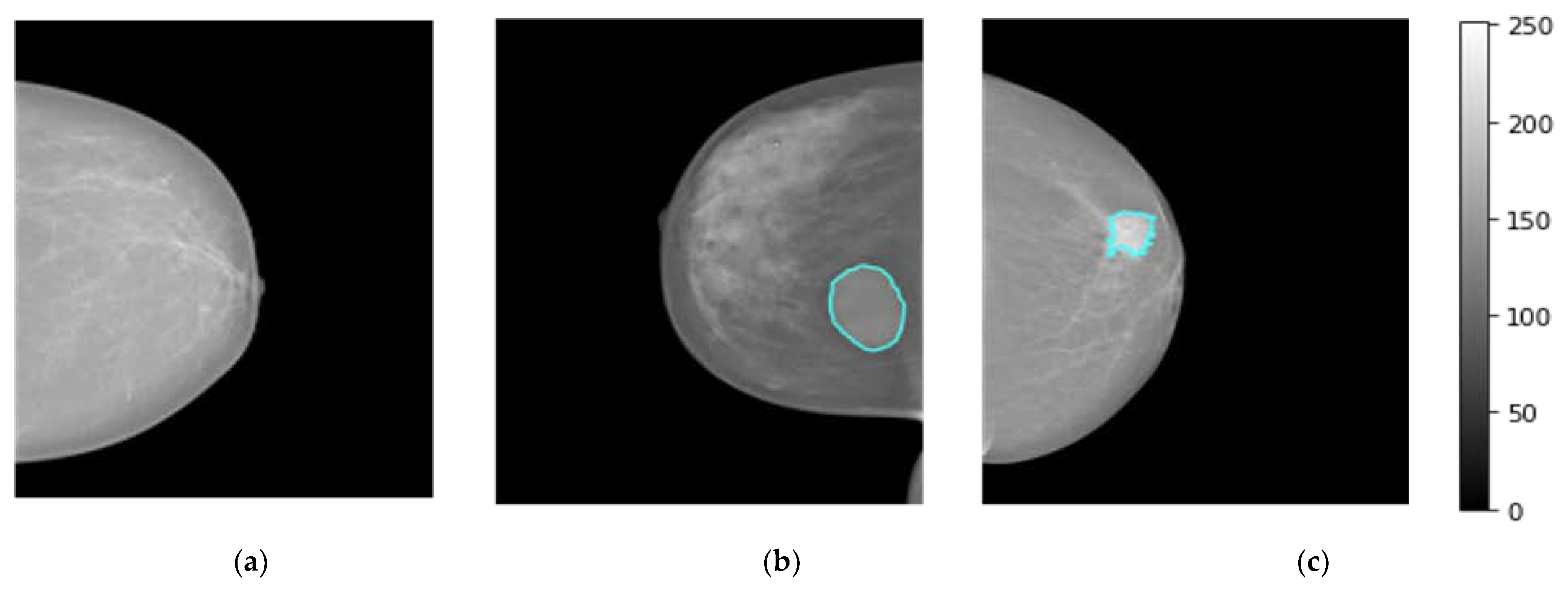 Diagnostics 13 00089 g002