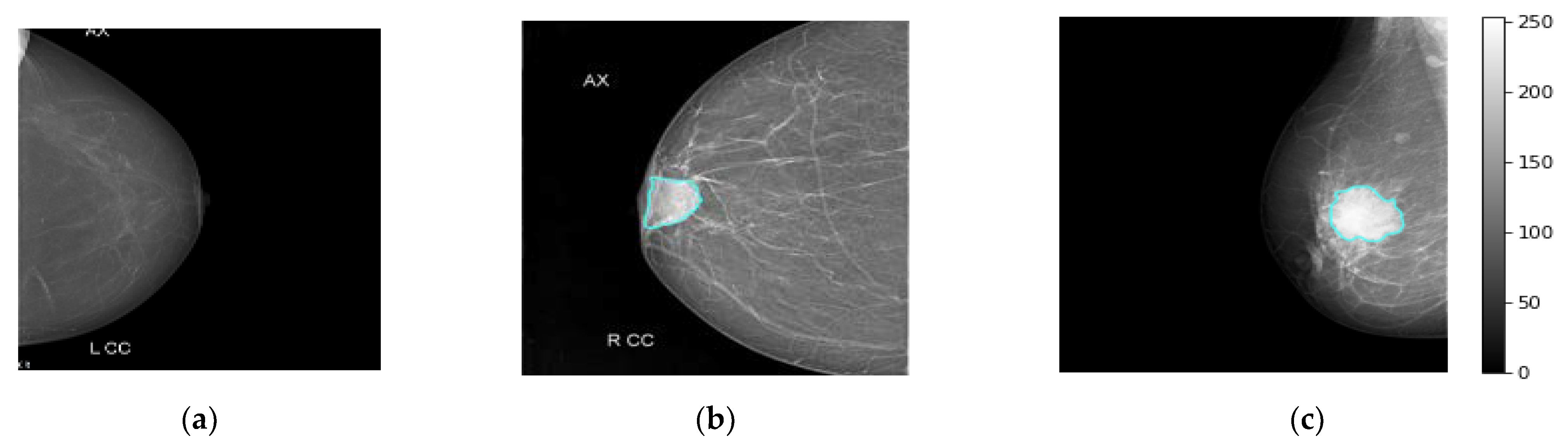 Diagnostics 13 00089 g003