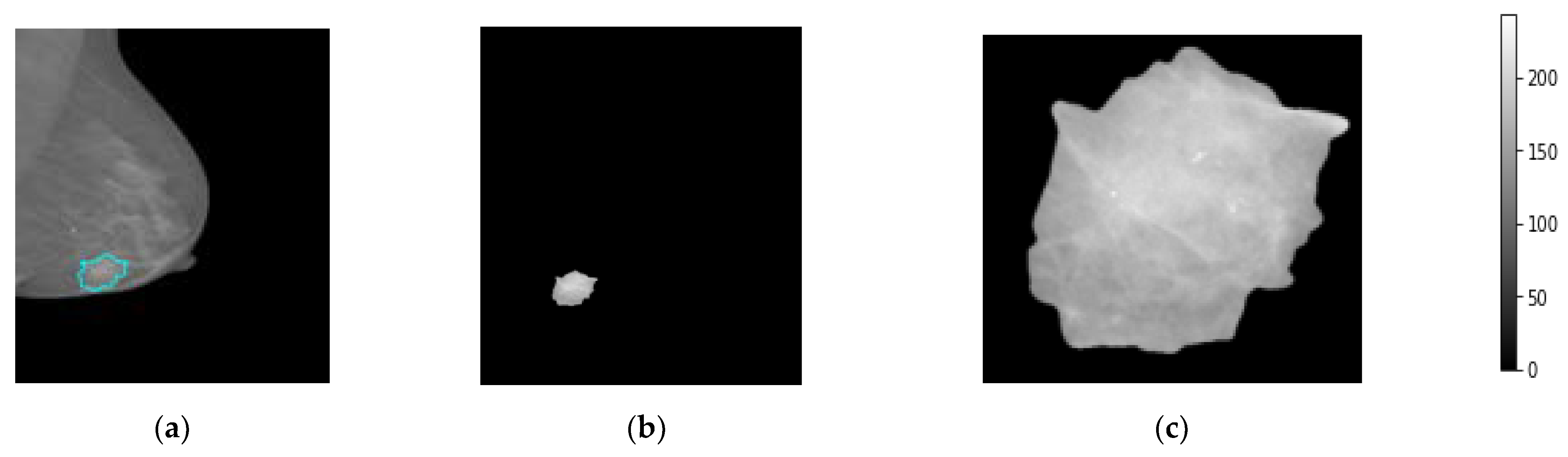 Diagnostics 13 00089 g004