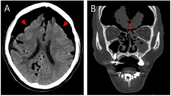 Diagnostics 13 00092 g001