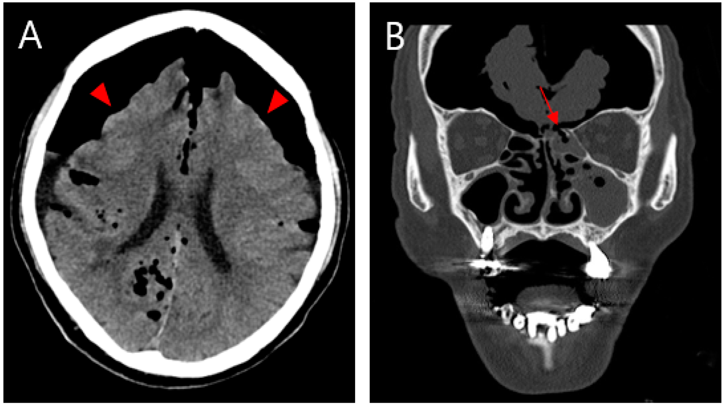 Diagnostics 13 00092 g001 Diagnostics 13 00092 g001