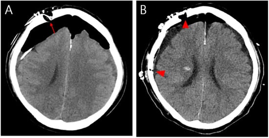Diagnostics 13 00092 g003