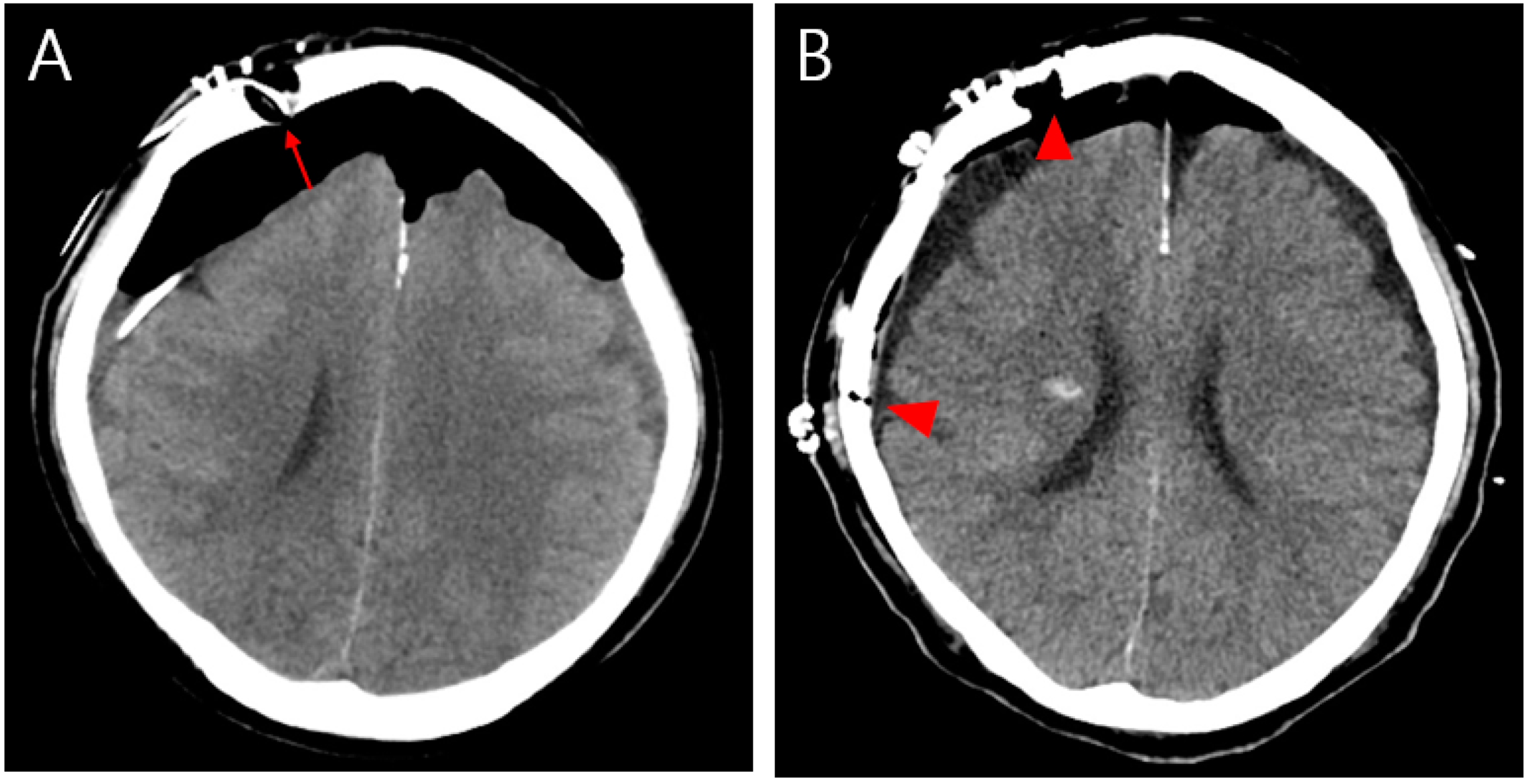 Diagnostics 13 00092 g003 Diagnostics 13 00092 g003
