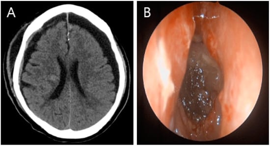 Diagnostics 13 00092 g004