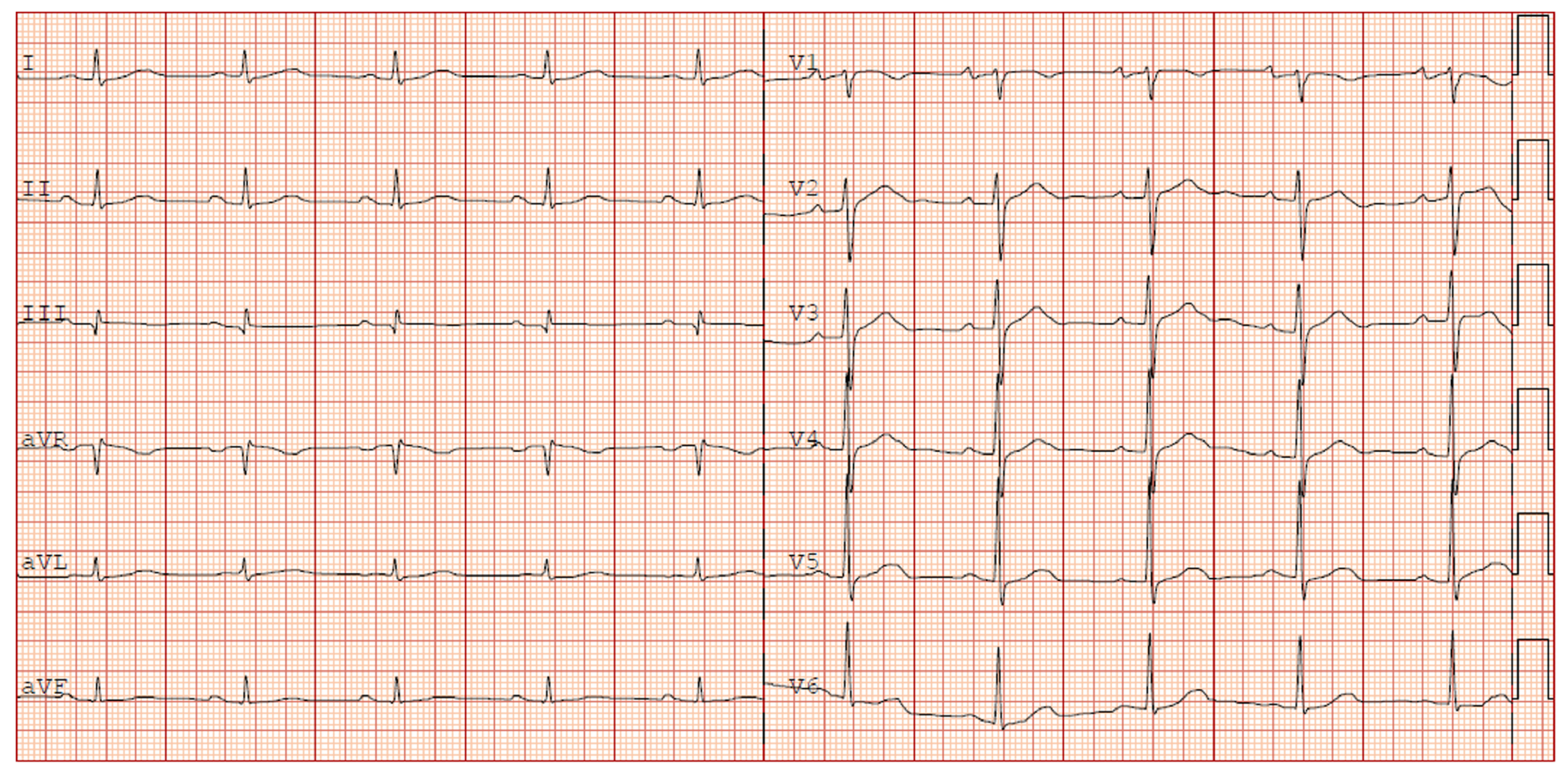 Diagnostics 13 00111 g002 Diagnostics 13 00111 g002