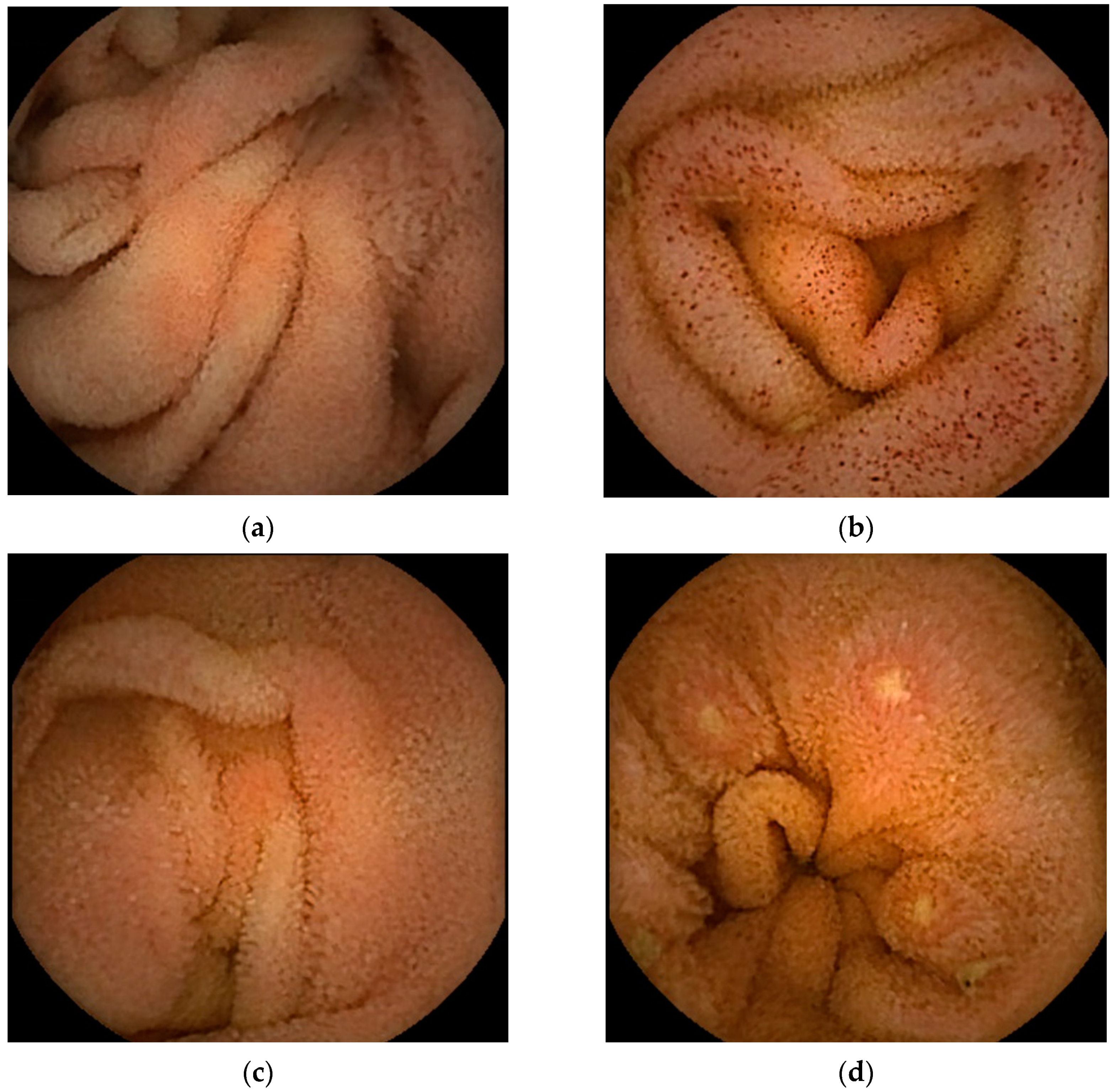 Diagnostics 13 00113 g002a