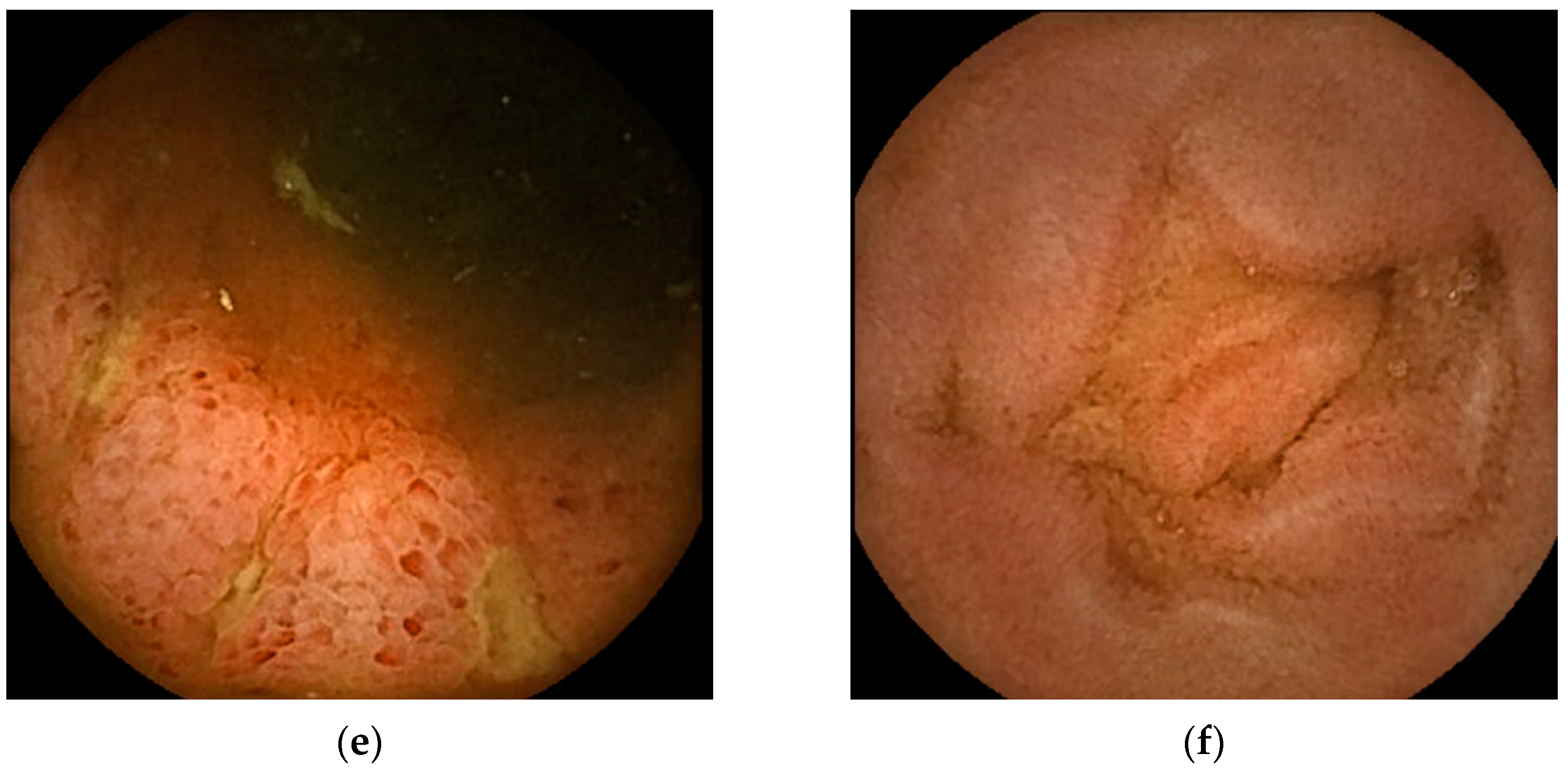 Diagnostics 13 00113 g002b