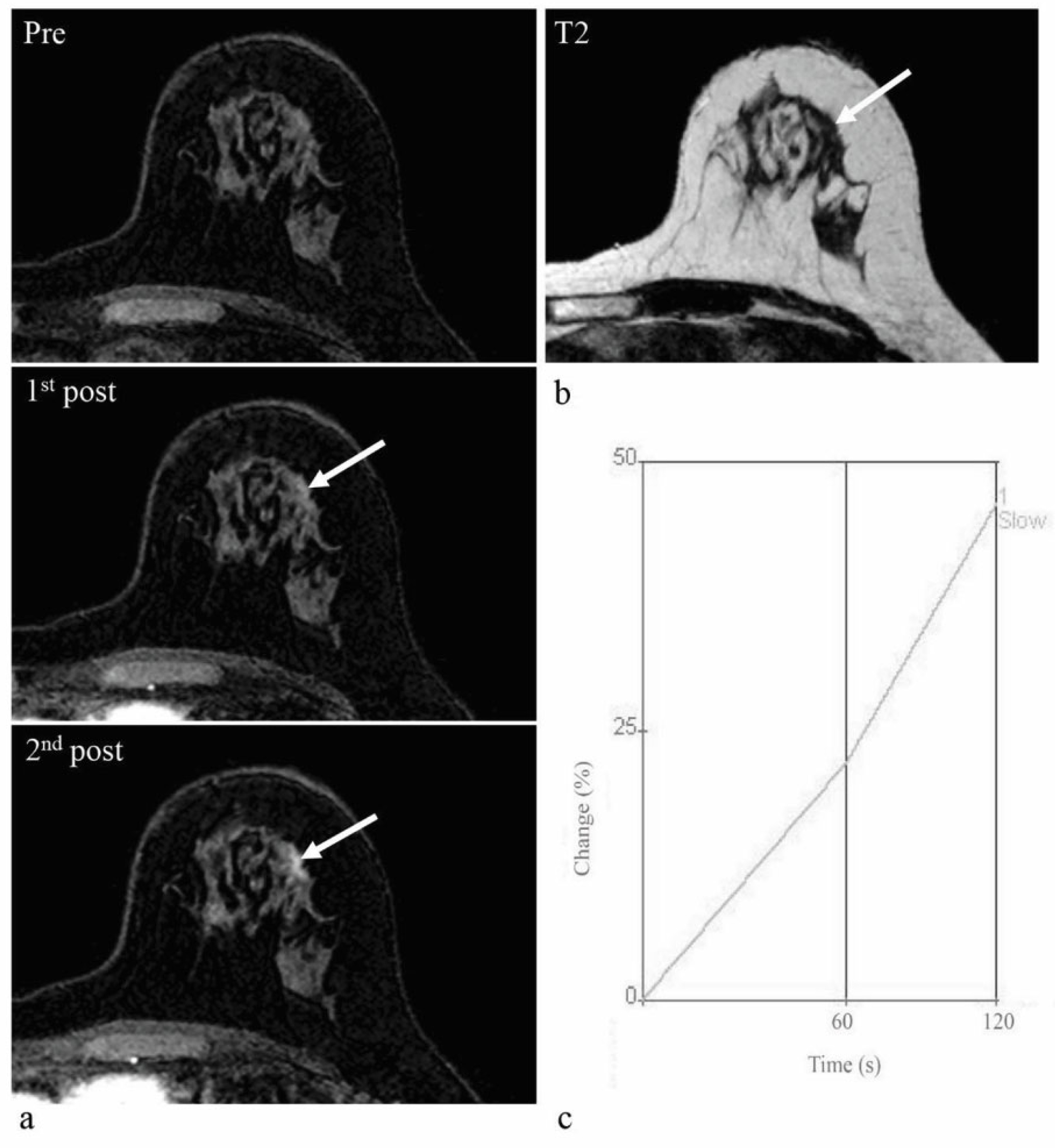 Diagnostics 13 00136 g004 Diagnostics 13 00136 g004